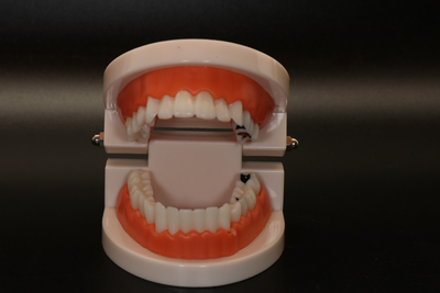 Модель демонстрационная стоматологическая с патологиями