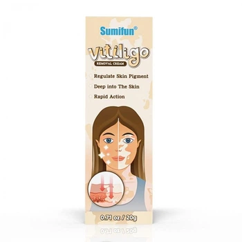 Зволожуючий крем для освітлення білих плям від вітіліго Vitiligo Removal Cream, 20г
