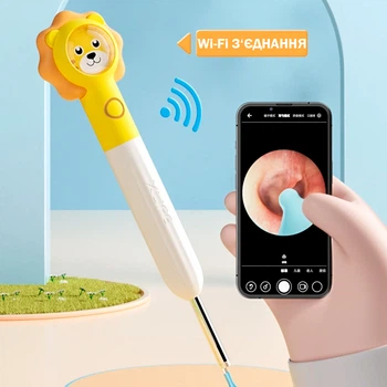 Детский очиститель ушей с WiFi и камерой FULL HD – средство для удаления ушной серы для детей Безопасный