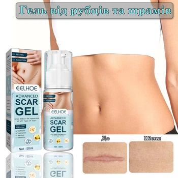 Гель для зменшення шрамів та рубців EELHOE Advanced Scar Gel 50мл з ретинолом та алантоїном