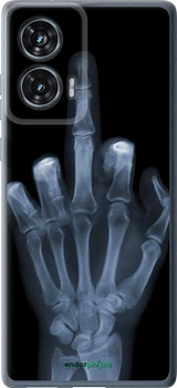 Чехол на Motorola Edge 50 Fusion Рука через рентген "1007u-3748-70447"