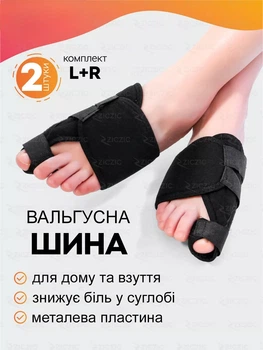 Вальгусные шины от косточки на большом пальце ног ортопедические корректор при вальгусной деформации стопы
