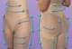Белье утягивающее для коррекции фигуры Slim'n Lift Aire [L] (Арт. B100) - изображение 2