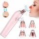 3в1 Вакуумный очиститель пор с функцией LED терапии прибор для пилинга алмазной микродермабразии XPREEN 027 Розовый - изображение 2
