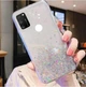 Блестящий чехол с серебряной фольгой Samsung Galaxy M30s (SM-M307F) - изображение 1