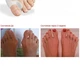 Фиксатор Корректор Большого Пальца Ноги Valgus Pro Силиконовый от Косточки и Вальгусной Деформации Стопы Комплект 2 шт - изображение 7