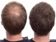 Загусник для волосся Toppik Hair Building Fibers Grey - зображення 2
