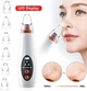 Вакуумный очиститель пор 400 маг Vacuum Acne Removal Tool Белый (SN9QI5007) - изображение 3