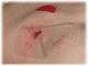 Повязка окклюзионная вентилируемая VENT CHEST SEAL TWIN - изображение 4
