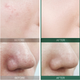 Тонер SOME BY MI AHA-BHA-PHA 30 Days Miracle Toner кислотный отшелушивающий, 30 мл - изображение 2