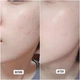 Тонер SKIN1004 Madagascar Centella Hyalu-Cica Brightening Toner увлажняющий с центеллой и гиалуроновой кислотой, 30 мл - изображение 5