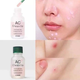Двухфазная сыворотка ETUDE HOUSE AC Clean Up Pink Powder Spot для точечного применения при высыпаниях, 15 мл - изображение 3