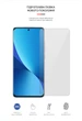 Гідрогелева плівка ArmorStandart для Xiaomi Redmi Note 12 5G (ARM65180) Transparent - зображення 2