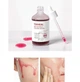 Пилинг-сыворотка для лица Esthetic House Toxheal Red Glycolic Peeling Serum, 100мл 23408752КР9 - изображение 4