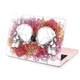 Чехол пластиковый для Apple MacBook Neo 13 (A18 Pro) 2026 (Цветочные черепа) A3404 макбук нэо 13" inch - изображение 6