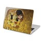 Чехол пластиковый для Apple MacBook Neo 13 (A18 Pro) 2026 (Поцелуй, Густав Климт) A3404 макбук нэо 13" inch - изображение 1