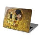 Чехол пластиковый для Apple MacBook Neo 13 (A18 Pro) 2026 (Поцелуй, Густав Климт) A3404 макбук нэо 13" inch - изображение 8