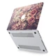 Чехол пластиковый для Apple MacBook Neo 13 (A18 Pro) 2026 (Прекрасные розы) A3404 макбук нэо 13" inch - изображение 2