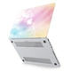 Чохол пластиковий для Apple MacBook Air 13 2018-2020 (Райдужні хмари) A1931/A1932/A2179/A2337 макбук ейр M1 аір 13.3" - зображення 2