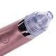 Апарат для чищення обличчя вакуумний Beauty XN-8030 рожевий з 5 режимами + 4 насадки - зображення 5
