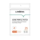 Патчи от прыщей дневные LANBENA Acne Pimple Patch Daily Use (25 шт) - изображение 1