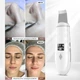 Ультразвуковий скрабер Ultrasonic Skin Cleaner GMCX6 з LED-дисплеєм, іонізацією і функцією нагрівання - зображення 7