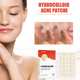 Пластир від акне та прищів Hydrocolloid Acne Patche 144 шт - зображення 4