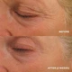 Интенсивный лифтинг-крем для век HydroPeptide Eye Authority, 15 мл REA - изображение 3