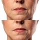 Микротоковый RF лифтинг-массажёр для лица MEDICA+ Skin Lifting 7.0 White Япония (EMS+LED) - изображение 6