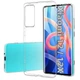 Чeхол-накладка BeCover для Xiaomi 12/12X Transparancy (708343) - изображение 1