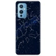 Чехол для OnePlus 9 (азиатская версия) Stardom (15360040132138180) - изображение 1