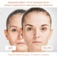 EMS МИКРОТОК MEDICA+ ЛИФТИНГ-МАССАЖЕР для лица SKIN LIFTING 6.0 WHITE (ЯПОНИЯ) - изображение 3