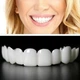 Съемные виниры для зубов зоны улыбки Perfect White Smile с кейсом для хранения - изображение 4