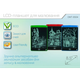 Графический планшет LCD-планшет для рисования Writing Tablet 8.5 дюймов Green - изображение 5