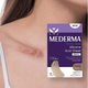 Силиконовый пластырь от шрамов и рубцов Mederma Silicone Scar Sheet Маленький (4х8 см) - изображение 11