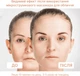 Микротоковый лифтинг-массажер для тела MEDICA+ Skin Lifting 6.0 белый - изображение 7