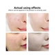 Крем от акне и прыщей Venzen anti acne точечный с никотинамидом для проблемной кожи 20 г - изображение 3