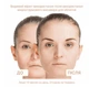Лифтинг-массажер для лица EMS микроток MEDICA+ SKIN LIFTING 6.0 PINK - изображение 10