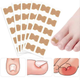 Пластир для корекції врослого нігтя Toenail Correction Sticker 20 шт - зображення 1