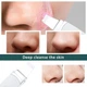 Ультразвуковий скрабер для чищення обличчя Ultrasonic Skin Scrubber Н2 - зображення 8