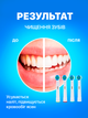 Насадки EB17-X sensitive clean для Oral b електричних зубних щіток чутливих зубів та ясен - зображення 5