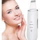 Ультразвуковой скрабер для чистки лица Ultrasonic Shovel Beauty Start - изображение 1