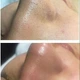 Ультразвуковой скрабер для чистки лица Ultrasonic Shovel Beauty Start - изображение 3