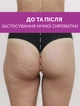 Суперконцентрированная антицеллюлитная ночная сыворотка для тела Reclaire - изображение 3