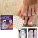 Защитные пластыри для ногтей Elastic Toenail Correction Sticker (50 шт) - изображение 2