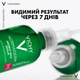 Сыворотка-пилинг Vichy Normaderm для коррекции недостатков жирной и проблемной кожи лица 30 мл (3337875791984) - изображение 6