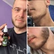 Лосьон для роста бороды MinoX 7% - изображение 2