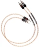 Кабель Kimber Kable Timbre Ultraplate Black RCA Type 1m - изображение 1