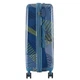 Валіза Semi Line 28" (L) Blue Pattern (T5652-3) - изображение 4