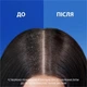 Шампунь Head & Shoulders Проти лупи Цитрусова свіжість 800 мл (8700216156172) - зображення 3